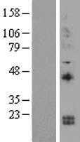 IL15 (NM_172174) Human Tagged ORF Clone