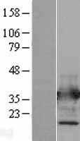 Annexin V(ANXA5) (NM_001154) Human Tagged ORF Clone