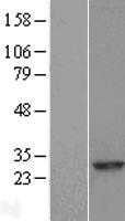 RAB8A (NM_005370) Human Tagged ORF Clone