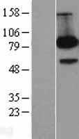 FE65(APBB1) (NM_001164) Human Tagged ORF Clone