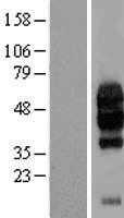 GI24(VSIR) (NM_022153) Human Tagged ORF Clone