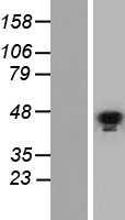GATA5 (NM_080473) Human Tagged ORF Clone