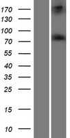 RED1(ADARB1) (NM_001112) Human Tagged ORF Clone
