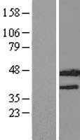 INDOL1(IDO2) (NM_194294) Human Tagged ORF Clone