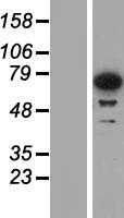 IMP3(IGF2BP3) (NM_006547) Human Tagged ORF Clone