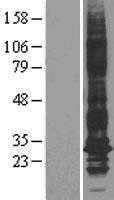 Aquaporin 1(AQP1) (NM_198098) Human Tagged ORF Clone