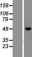 Vitamin D Receptor (VDR) (NM_001017535) Human Tagged ORF Clone