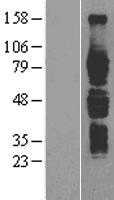 IL6R (NM_000565) Human Tagged ORF Clone