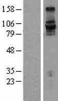 Integrin beta 7(ITGB7) (NM_000889) Human Tagged ORF Clone