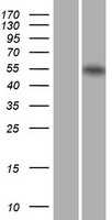 Retinoic Acid Receptor alpha(RARA) (NM_000964) Human Tagged ORF Clone