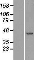 XBP1 (NM_001079539) Human Tagged ORF Clone