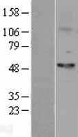 Fascin(FSCN1) (NM_003088) Human Tagged ORF Clone