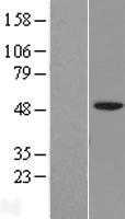 IGSF11 (NM_152538) Human Tagged ORF Clone