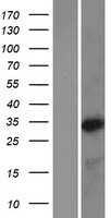 BAPX1(NKX3-2) (NM_001189) Human Tagged ORF Clone