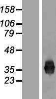 Junctional Adhesion Molecule 1(F11R) (NM_016946) Human Tagged ORF Clone