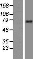 GGA2 (NM_015044) Human Tagged ORF Clone