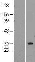 LCLAT1 (NM_182551) Human Tagged ORF Clone