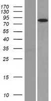 Glucocorticoid Receptor(NR3C1) (NM_000176) Human Tagged ORF Clone
