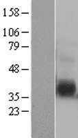 IL12B (NM_002187) Human Tagged ORF Clone