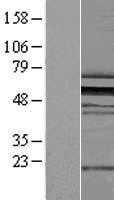 ZNF259(ZPR1) (NM_003904) Human Tagged ORF Clone