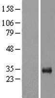 LOX 1(OLR1) (NM_002543) Human Tagged ORF Clone