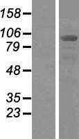 ALIX(PDCD6IP) (NM_013374) Human Tagged ORF Clone