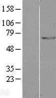 GAD67(GAD1) (NM_000817) Human Tagged ORF Clone