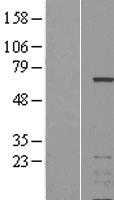 IKZF3 (NM_012481) Human Tagged ORF Clone