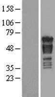 PAK4 (NM_005884) Human Tagged ORF Clone