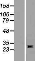 Flt3 ligand(FLT3LG) (NM_001459) Human Tagged ORF Clone