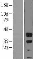 BMI1 (NM_005180) Human Tagged ORF Clone