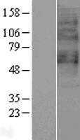 GPR65 (NM_003608) Human Tagged ORF Clone