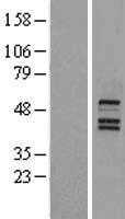 Bile Acid Receptor(NR1H4) (NM_005123) Human Tagged ORF Clone