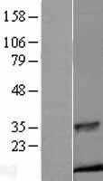 Insulin(INS) (NM_000207) Human Tagged ORF Clone
