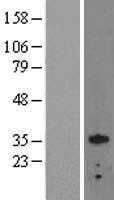 OTX2 (NM_021728) Human Tagged ORF Clone