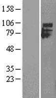 IFNAR1 (NM_000629) Human Tagged ORF Clone