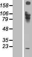 IL12RB1 (NM_005535) Human Tagged ORF Clone
