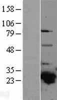 GSTA4 (NM_001512) Human Tagged ORF Clone