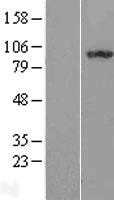 ILF3 (NM_012218) Human Tagged ORF Clone