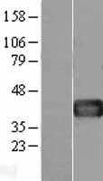 Follistatin(FST) (NM_013409) Human Tagged ORF Clone