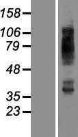 GLUT4(SLC2A4) (NM_001042) Human Tagged ORF Clone