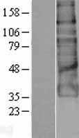 GPR56(ADGRG1) (NM_005682) Human Tagged ORF Clone