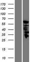 GDA (NM_004293) Human Tagged ORF Clone