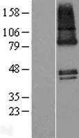 ZDHHC9 (NM_001008222) Human Tagged ORF Clone
