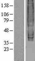 GPR183 (NM_004951) Human Tagged ORF Clone