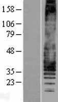 Leukotriene B4 Receptor(LTB4R) (NM_181657) Human Tagged ORF Clone
