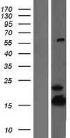 ATP5D (NM_001687) Human Tagged ORF Clone