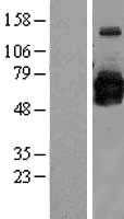 GOLPH2(GOLM1) (NM_177937) Human Tagged ORF Clone
