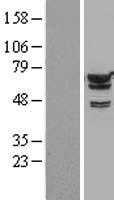 IGF2BP2 (NM_006548) Human Tagged ORF Clone