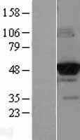 Glucokinase(GCK) (NM_000162) Human Tagged ORF Clone